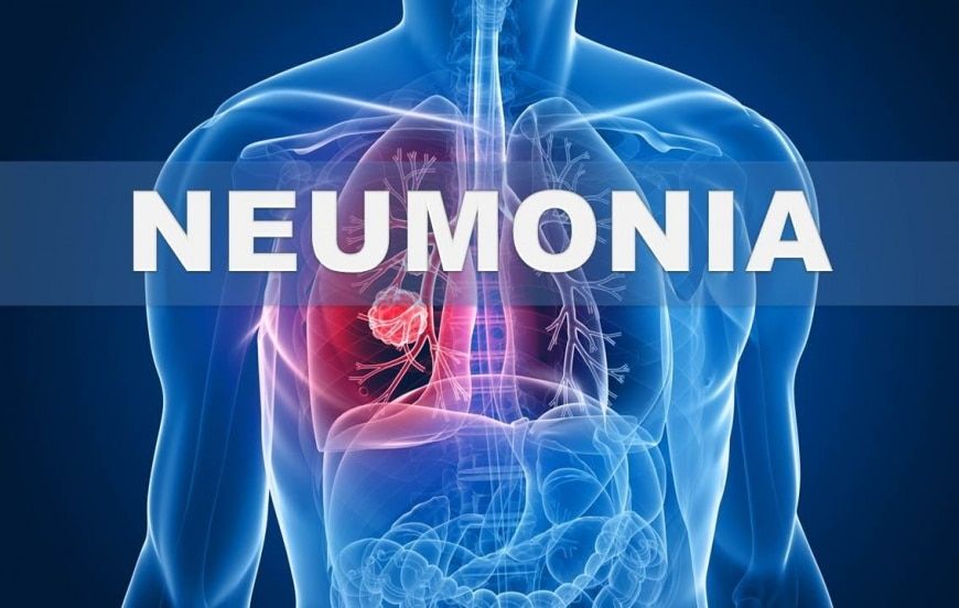 neumonia