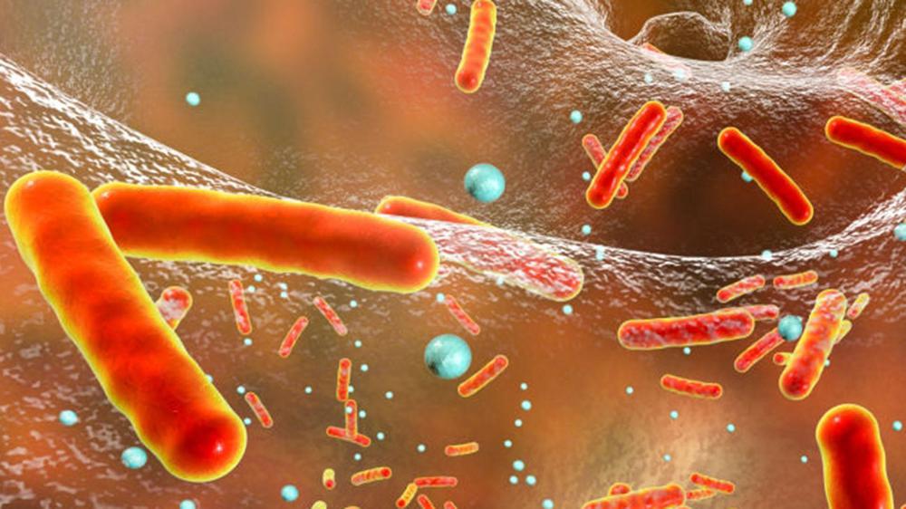 tuberculosis